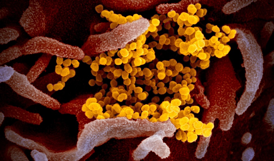 A scanning electron microscope image from the NIH's National Institute of Allergy and Infectious Diseases shows SARS-CoV-2 in yellow, also known as the novel coronavirus